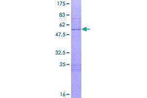 Image no. 1 for Homeobox A6 (HOXA6) (AA 1-233) protein (GST tag) (ABIN1306935)