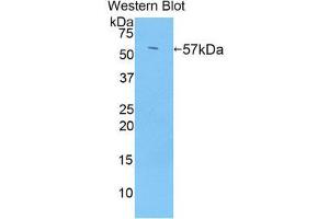 Western Blotting (WB) image for anti-Transglutaminase 1, Keratinocyte (TGM1) (AA 433-692) antibody (ABIN1860740) (TGM1 anticorps  (AA 433-692))
