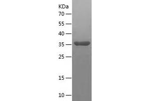 Western Blotting (WB) image for Cyclin-Dependent Kinase 2 Associated Protein 2 (CDK2AP2) (AA 1-126) protein (His-IF2DI Tag) (ABIN7122530)