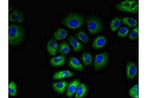 Immunofluorescent analysis of A549 cells using ABIN7171530 at dilution of 1:100 and Alexa Fluor 488-congugated AffiniPure Goat Anti-Rabbit IgG(H+L)