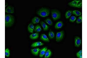 Immunofluorescent analysis of A549 cells using ABIN7171530 at dilution of 1:100 and Alexa Fluor 488-congugated AffiniPure Goat Anti-Rabbit IgG(H+L) (TAS1R2 anticorps  (AA 183-362))