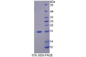 SDS-PAGE (SDS) image for Fatty Acid Binding Protein 6, Ileal (FABP6) (AA 1-128) protein (His tag) (ABIN6239149)