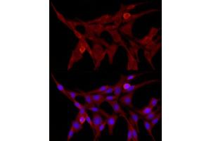 Immunofluorescence analysis of PC-12 cells using TRIM21/SS-A Rabbit pAb (ABIN3015761, ABIN3015762, ABIN3015763 and ABIN6219108) at dilution of 1:50 (40x lens). (TRIM21 anticorps  (AA 80-330))