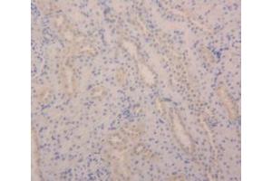 Detection of ANGPT2 in Rat Kidney Tissue using Polyclonal Antibody to Angiopoietin 2 (ANGPT2)
