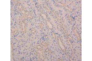 Detection of ANGPT2 in Rat Kidney Tissue using Polyclonal Antibody to Angiopoietin 2 (ANGPT2) (Angiopoietin 2 anticorps  (AA 33-243))