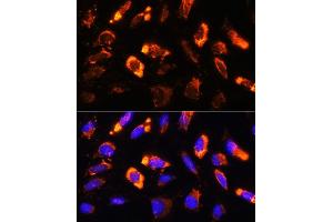 Immunofluorescence analysis of U2OS cells using BNP Rabbit pAb (ABIN3023135, ABIN3023136, ABIN3023137, ABIN1513273 and ABIN6219406) at dilution of 1:100.