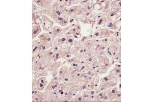 (ABIN6242410 and ABIN6578870) staining IL1R in human liver tissue sections by Immunohistochemistry (IHC-P - paraformaldehyde-fixed, paraffin-embedded sections). (IL1RAP anticorps  (AA 484-518))