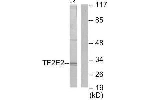 Western Blotting (WB) image for anti-General Transcription Factor IIE, Polypeptide 2 (GTF2E2) (Internal Region) antibody (ABIN1849294) (GTF2E2 anticorps  (Internal Region))