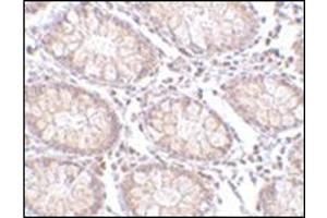 Immunohistochemistry of PTK7 in human colon tissue with this product at 5 μg/ml. (PTK7 anticorps  (N-Term))