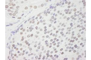 Immunohistochemistry (IHC) image for anti-Cleavage and Polyadenylation Specific Factor 1, 160kDa (CPSF1) (AA 1392-1442) antibody (ABIN7448944)