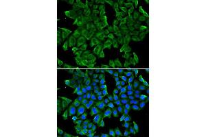 Immunofluorescence analysis of MCF-7 cell using REG3G antibody. (REG3g anticorps)
