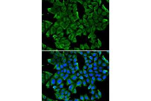 Immunofluorescence analysis of MCF-7 cell using REG3G antibody. (REG3g anticorps)