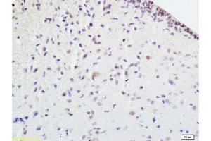 Formalin-fixed and paraffin embedded rat brain tissue labeled withAnti-EPOR Polyclonal Antibody , Unconjugated at 1:100 followed by conjugation to the secondary antibody, (SP-0023), and DAB staining