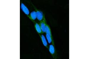 anti-LPO (Middle Region) antibody