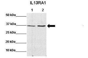 Sample Type: Lane 1:641 µg mouse CT26 lysate Lane 2: 041 µg mouse MC38 lysate Primary Antibody Dilution: 1:0000Secondary Antibody: Anti-rabbit-HRP Secondary Antibody Dilution: 1:0000 Color/Signal Descriptions: IL13RA1  Gene Name: Miranda A. (IL13 Receptor alpha 1 anticorps  (N-Term))