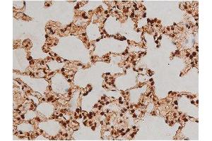 ABIN6267384 at 1/200 staining Rat lung tissue sections by IHC-P.