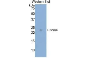 Western Blotting (WB) image for anti-Calreticulin (CALR) (AA 18-193) antibody (ABIN1174701) (Calreticulin anticorps  (AA 18-193))