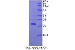 SDS-PAGE (SDS) image for Colony Stimulating Factor 3 Receptor (Granulocyte) (CSF3R) (AA 655-838) protein (His tag) (ABIN2120869) (CSF3R Protein (AA 655-838) (His tag))