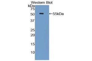 Detection of Recombinant LBP, Mouse using Polyclonal Antibody to Lipopolysaccharide Binding Protein (LBP) (LBP anticorps  (AA 25-481))