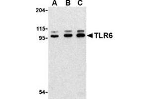 Western blot analysis of TLR6 in Jurkat cell lysate with this product at (A) 0. (TLR6 anticorps  (Center))
