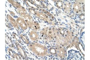 GEM antibody was used for immunohistochemistry at a concentration of 4-8 ug/ml to stain Epithelial cells of renal tubule (arrows) in Human Kidney.