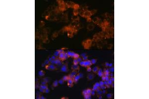 Immunofluorescence analysis of Hep G2 cells using Sonic Hedgehog (Shh) (Shh) Rabbit mAb (ABIN6131215, ABIN6147930, ABIN6147931 and ABIN7101409) at dilution of 1:100 (40x lens). (Sonic Hedgehog anticorps)
