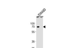 Western blot analysis of ETV5 Antibody (N-term) Pab (ABIN654690 and ABIN2844382) pre-incubated without(lane 1) and with(lane 2) blocking peptide in S cell line lysate. (ETV5 anticorps  (N-Term))