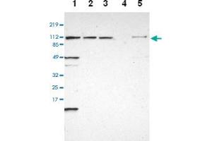 Western blot analysis of Lane 1: RT-4, Lane 2: U-251 MG, Lane 3: A-431, Lane 4: Liver, Lane 5: Tonsil with INTS6 polyclonal antibody at 1:250 - 1:500 dilution. (INTS6 anticorps)