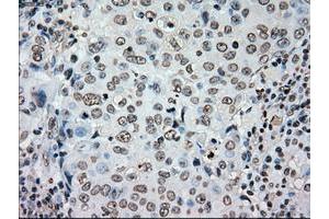 Image no. 17 for anti-Polo-Like Kinase 1 (PLK1) antibody (ABIN1500282)