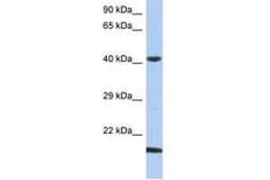 Image no. 1 for anti-SEC14-Like 4 (SEC14L4) (N-Term) antibody (ABIN6743871) (SEC14L4 anticorps  (N-Term))