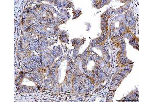 IHC analysis of Poliovirus Receptor/PVR using anti-Poliovirus Receptor/PVR antibody (ABIN7601072). (Poliovirus Receptor anticorps  (AA 28-331))