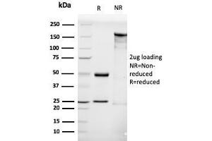 SDS-PAGE Analysis Purified LHCGR Mouse Monoclonal Antibody (LHCGR/1416). (LHCGR anticorps  (AA 70-410))