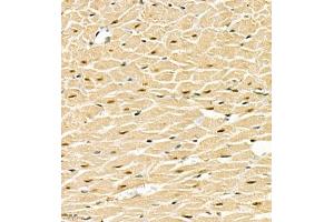 Immunohistochemistry of paraffin embedded rat heart using SMNDC1 (ABIN7075773) at dilution of 1:1000 (400x lens) (SMNDC1 anticorps)