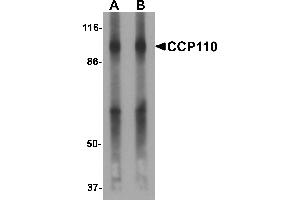 Western blot analysis of CCP110 in human colon tissue lysate with CCP110 antibody at (A) 1 and (B) 2 µg/mL. (CP110 anticorps  (C-Term))
