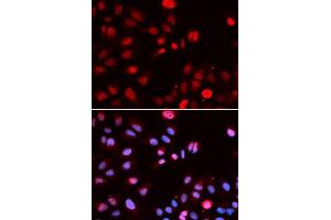 Immunofluorescence analysis of U2OS cells using MPG antibody. (MPG anticorps  (AA 1-293))