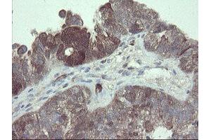 Image no. 15 for anti-TSC22 Domain Family, Member 1 (TSC22D1) antibody (ABIN1501540) (TSC22D1 anticorps)