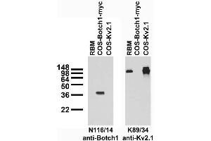 Adult rat brain membrane (RBM) and transfected cell immunoblot: extracts of RBM and COS cells transiently transfected with Myc- tagged Botch1 and untagged Kv2.