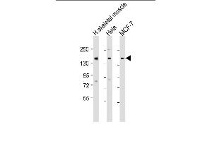 All lanes : Anti-TNRC6A Antibody (Center) at 1:1000-1:2000 dilution Lane 1: human skeletal muscle lysate Lane 2: Hela whole cell lysate Lane 3: MCF-7 whole cell lysate Lysates/proteins at 20 μg per lane. (TNRC6A anticorps  (AA 855-885))