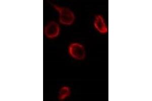 ABIN6276697 staining HuvEc by IF/ICC. (TIMP3 anticorps  (Internal Region))