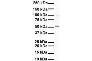 WB Suggested Anti-SNRP70 antibody Titration: 1 ug/mL Sample Type: Human Raji