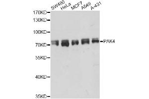 Western blot analysis of extracts of various cell lines, using PAK4 antibody (ABIN5998444) at 1/5000 dilution. (PAK4 anticorps)