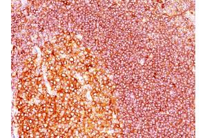 Formalin-fixed, paraffin-embedded human Tonsil stained with MALT1 Mouse Monoclonal Antibody (MT1/410).