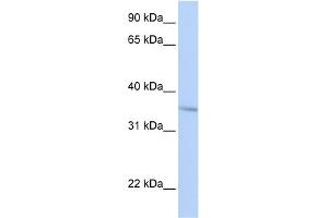 WB Suggested Anti-FHL3 Antibody Titration:  0. (FHL3 anticorps  (Middle Region))