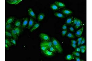 Immunofluorescent analysis of HepG2 cells using ABIN7152172 at dilution of 1:100 and Alexa Fluor 488-congugated AffiniPure Goat Anti-Rabbit IgG(H+L)