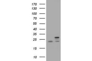 Image no. 3 for anti-NADH Dehydrogenase (Ubiquinone) 1 beta Subcomplex, 10, 22kDa (NDUFB10) antibody (ABIN1499673) (NDUFB10 anticorps)