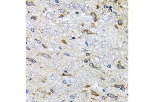 Immunohistochemistry of paraffin-embedded mouse spinal cord using BLZF1 antibody.