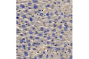 Immunohistochemistry of paraffin embedded mouse liver using AHSG (ABIN7073021) at dilution of 1:700 (400x lens)