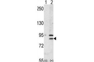 Western Blotting (WB) image for anti-Bromodomain Containing 2 (BRD2) antibody (ABIN3003651) (BRD2 anticorps)