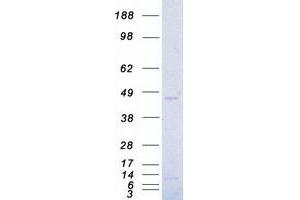 Validation with Western Blot