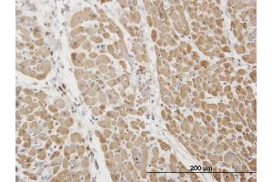 Immunoperoxidase of monoclonal antibody to TNNI3 on formalin-fixed paraffin-embedded human heart.